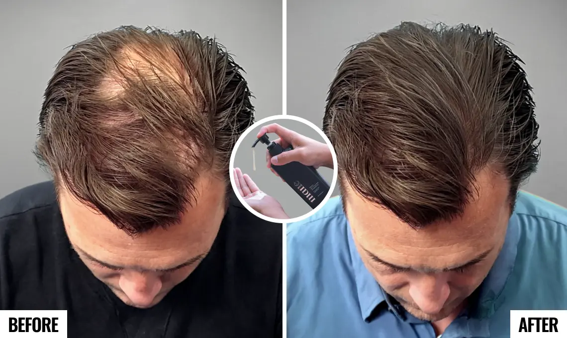 Before and after hair regrowth with Mane Root Activator Shampoo