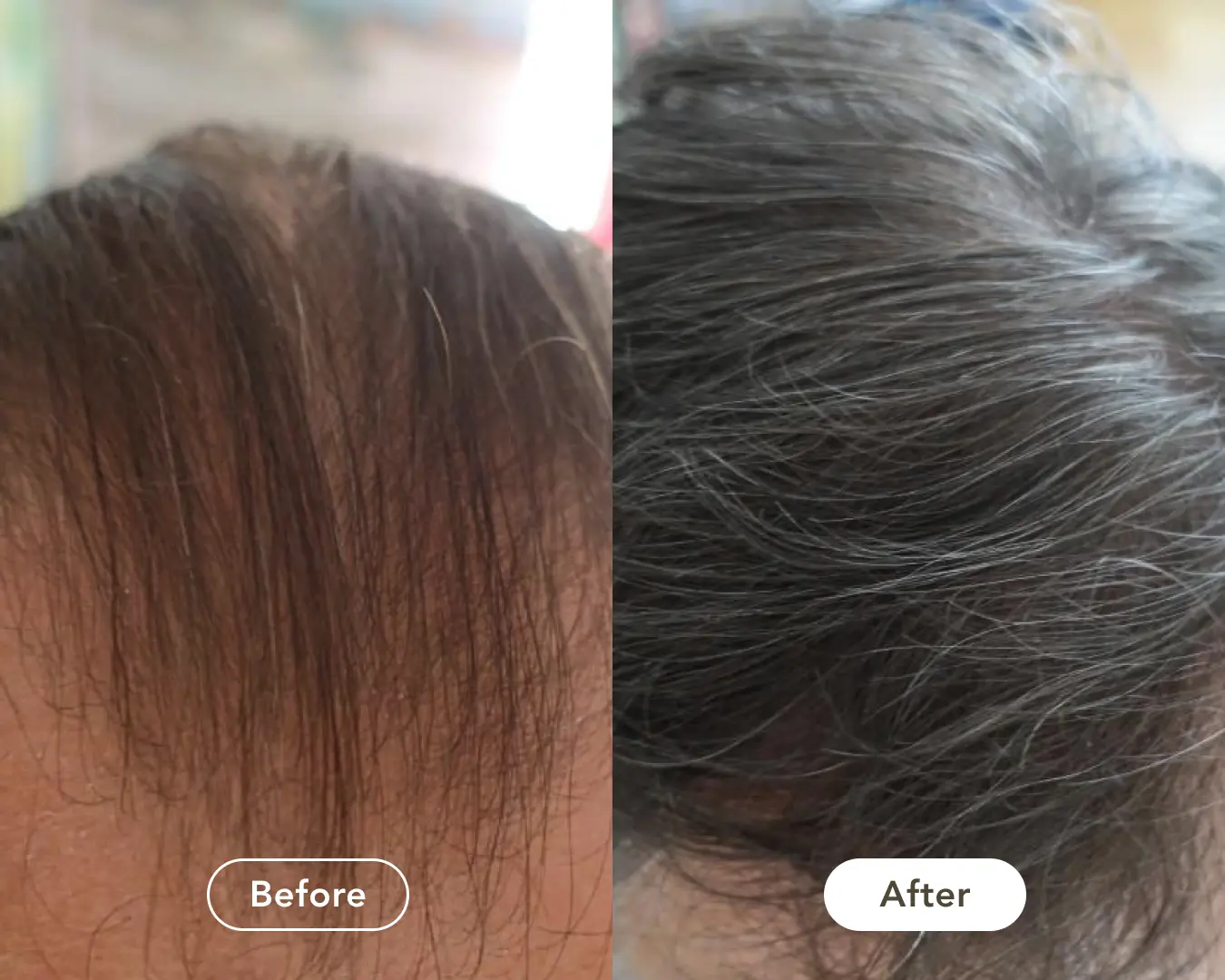 Before and after: thinning hair at the part