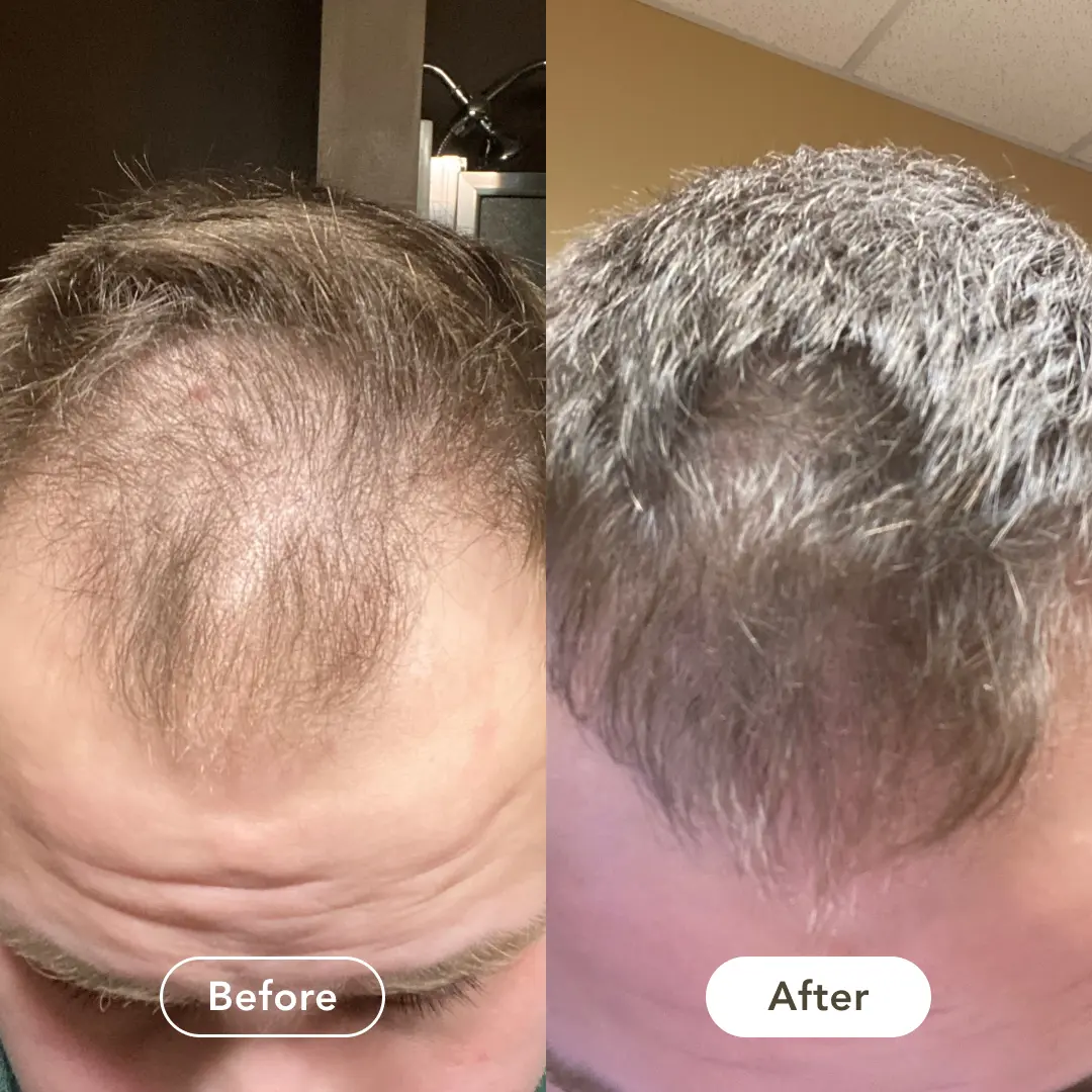 Testimonial – Jesse, 40