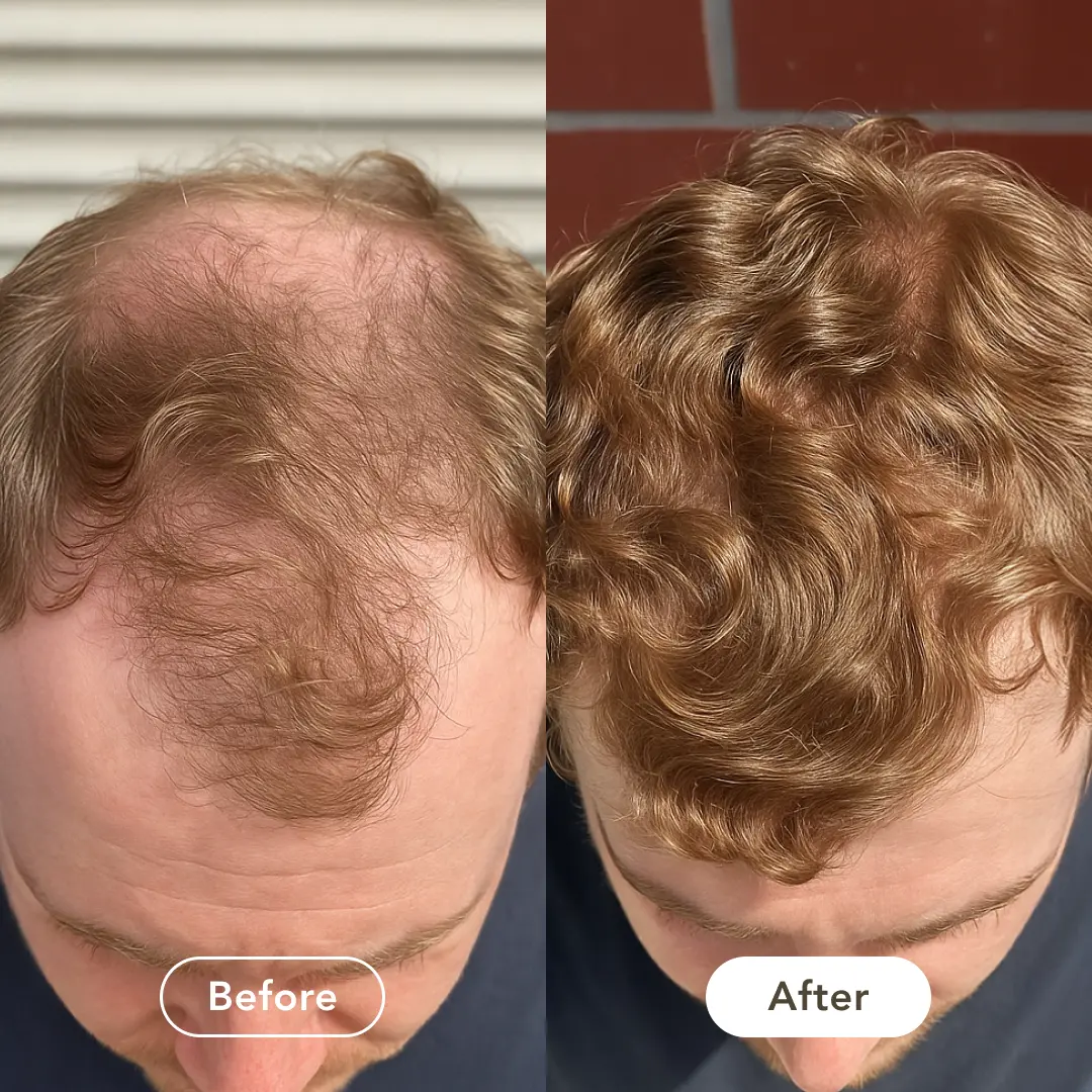 Testimonial – Rob, 29