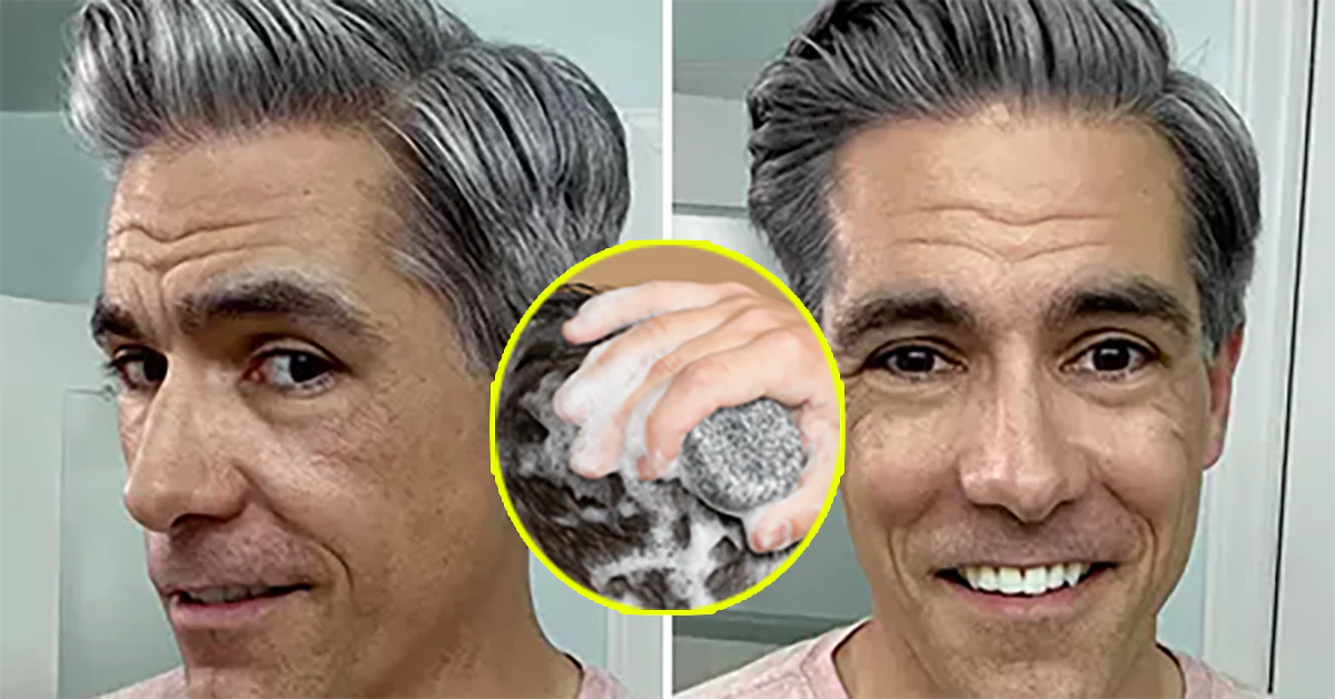 Reversing Gray Hair